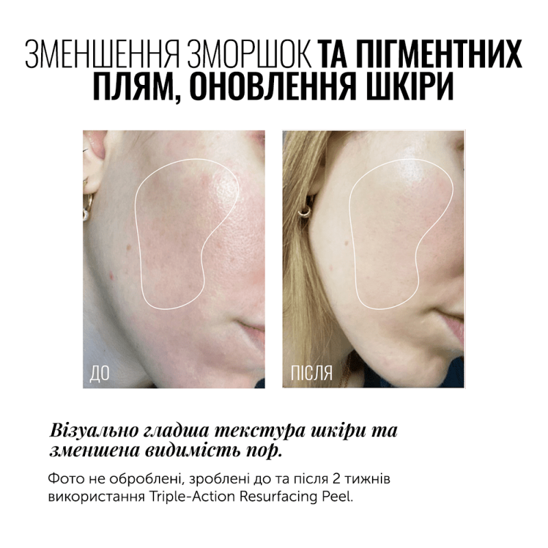 ПІЛІНГ ДЛЯ ОБЛИЧЧЯ TRIPLE ACTION RESURFACING PEEL. 60 мл INSTITUTUM - Зображення 3